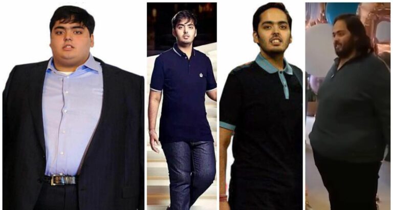 Anant Ambani Sick
